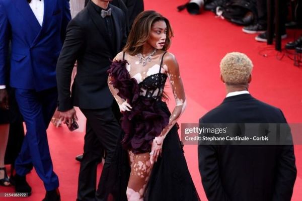 Người mẫu bạch biến chiếm spotlight, Hoa hậu Pia Wurtzbach hóa Cinderella tại Cannes